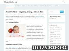 Miniaturka bialkowa.pl (Kompendium wiedzy na temat skazy białkowej)