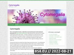 Zrzut strony Cytomegalia - objawy