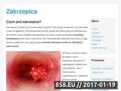 Miniaturka domeny e-zakrzepica.pl