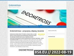 Miniaturka endometriosis.net.pl (Wszystkie informacje o endometriozie)