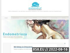 Miniaturka domeny endometrioza.org