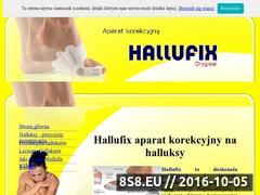 Miniaturka www.halufix.pl (Szyny na haluksy)