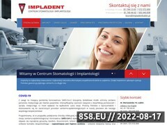 Miniaturka strony Klinika stomatologi w Lublinie - Impladent