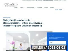 Miniaturka domeny implantis.com.pl
