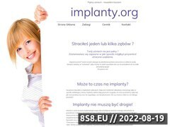 Miniaturka domeny www.implanty.org