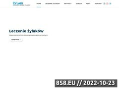 Miniaturka leczeniezylakow.com (Wszystko na temat leczenia żylaków)