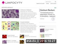 Miniaturka www.limfocyty.pl (Limfocyty portal medyczny)