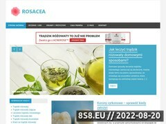 Zrzut strony Rosacea - trądzik różowaty
